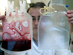Empleada de un laboratorio sostiene una bolsa de sangre de un cordón umbilical para ser criogenizada. / HOY/